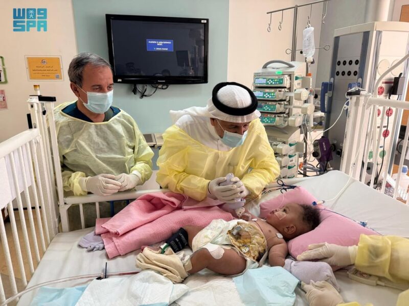 نظرة عن قرب على عملية فصل التوأم السيامي الصومالي واستقرار حالتهم