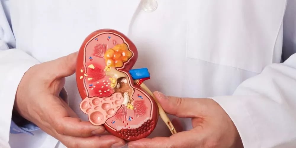 دليلك الكامل لتعزيز صحة الكلى بعد الخمسين