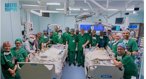 التقرير الكامل عن فصل التوأم الملتصق الفلبيني